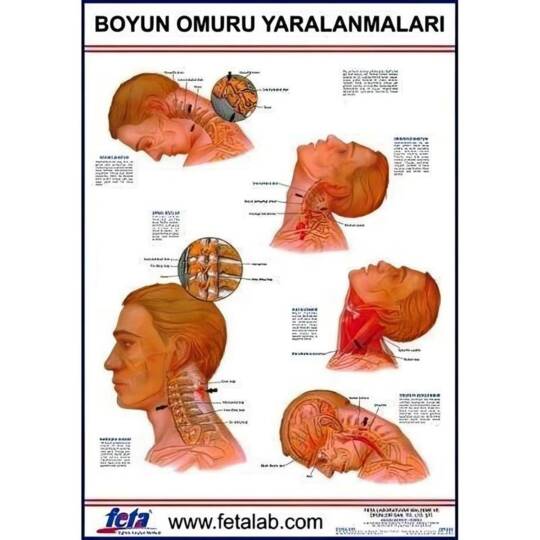 Oscar Baş Ve Boyun Yaralanmaları Eğitim Plakası