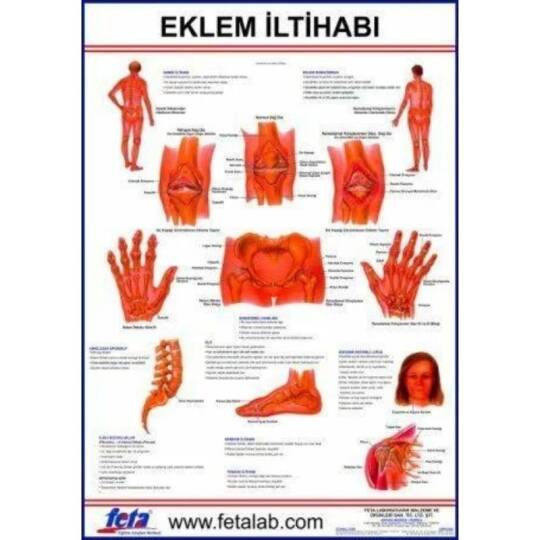 Oscar Eklem İltihabı Levhası