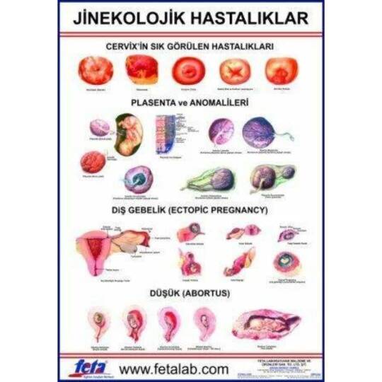 Oscar Jinekolojik Hastalıklar Eğitim Plakası