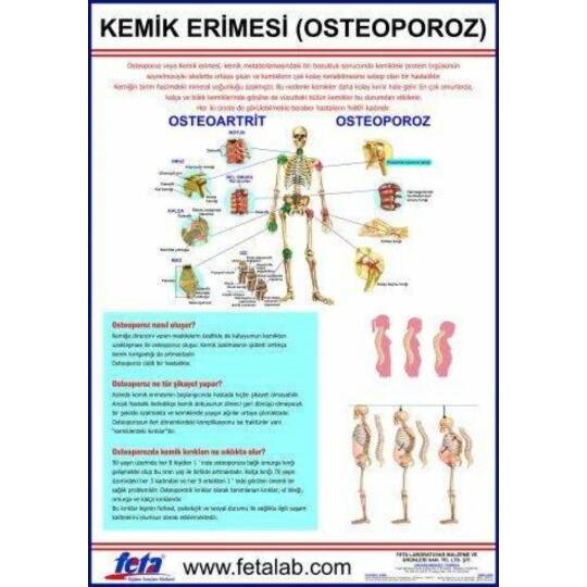 Oscar Osteoporoz Eğitim Plakası (Kemik Erimesi)